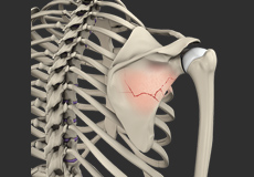 Sports Injury Management of Hand, Wrist and Elbow