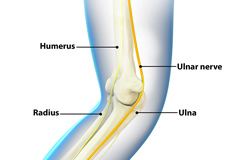 Ulnar Nerve Transposition